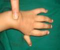 Case -1 Pre operation